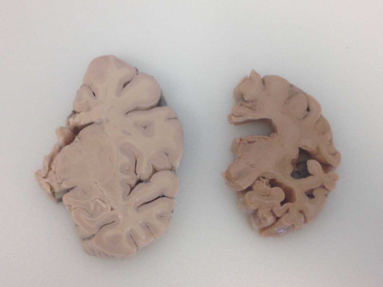 Brain X sections